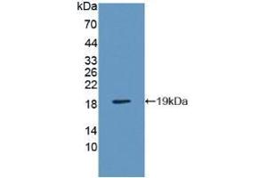 Figure. (VAPB antibody  (AA 1-132))