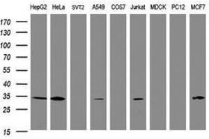 Image no. 5 for anti-Signal Recognition Particle Receptor, B Subunit (SRPRB) antibody (ABIN1501128) (SRPRB antibody)