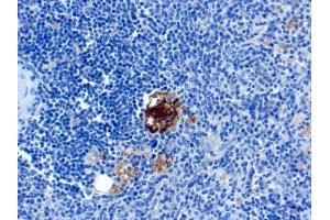 Formalin-fixed, paraffin-embedded human Spleen stained with TRAcP Monoclonal Antibody (SPM601). (ACP5 antibody)
