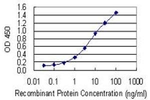 Detection limit for recombinant GST tagged GLI1 is 0. (GLI1 antibody  (AA 401-500))