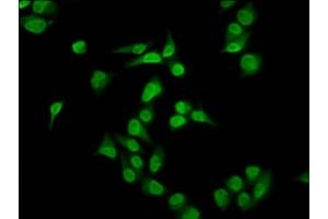 Immunofluorescence staining of Hela cells with ABIN7139583 at 1:2. (HIST1H4A antibody  (meArg35))