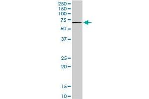 TBX18 monoclonal antibody (M05), clone 1A1. (T-Box 18 antibody  (AA 454-560))