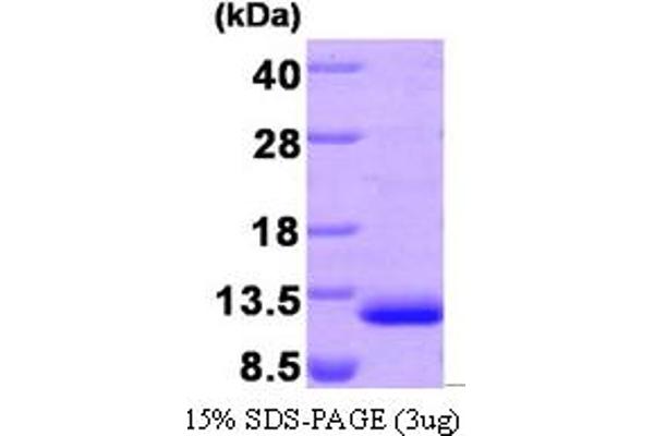 CCL22 Protein (AA 25-93) (His tag)