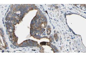 ABIN6274964 at 1/100 staining Human prostate tissue by IHC-P. (CBR1 antibody  (C-Term))