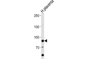 Western Blotting (WB) image for anti-Adenosine Monophosphate Deaminase 3 (AMPD3) antibody (ABIN3003542) (AMPD3 antibody)