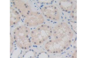 IHC-P analysis of Human Tissue, with DAB staining. (Retinoid X Receptor gamma antibody  (AA 12-220))