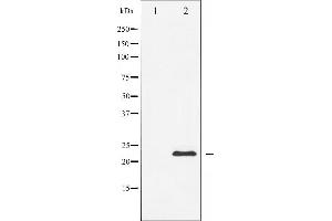 Western blot analysis of Caveolin-1 expression in NIH-3T3 whole cell lysates,The lane on the left is treated with the antigen-specific peptide. (Caveolin-1 antibody  (N-Term))