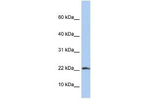IL1 beta antibody used at 1 ug/ml to detect target protein. (IL-1 beta antibody  (N-Term))