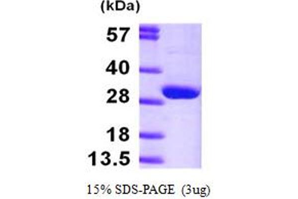 HPRT1 Protein (AA 1-218) (His tag)