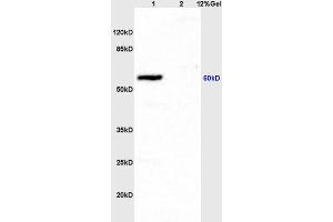 SDS-PAGE (SDS) image for anti-Intercellular Adhesion Molecule 1 (ICAM1) (AA 201-300) antibody (ABIN670806)