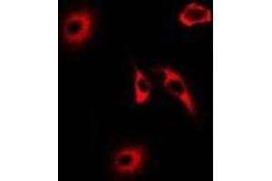 Immunofluorescent analysis of HNMT staining in U2OS cells. (HNMT antibody)