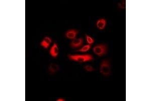 Immunofluorescent analysis of ATR staining in Hela cells. (ATR antibody)