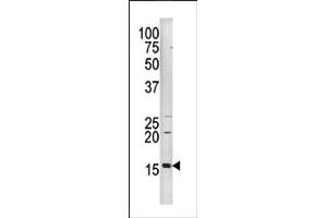 Image no. 1 for anti-Histone 3 (H3) (pSer10) antibody (ABIN358063) (Histone 3 antibody  (pSer10))