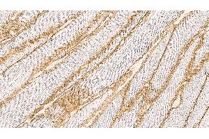 Human skeletal muscle: immunohistochemical staining on a frozen longitudinal section. (Dystroglycan antibody  (C-Term))