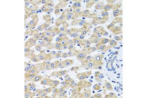 Immunohistochemistry of paraffin-embedded human liver using SERPINA7 antibody at dilution of 1:100 (40x lens). (SERPINA7 antibody)