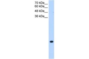 Western Blotting (WB) image for anti-Transmembrane Protein 75 (TMEM75) antibody (ABIN2463990) (TMEM75 antibody)