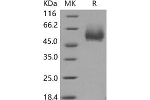 Western Blotting (WB) image for CD4 (CD4) (Active) protein (His tag) (ABIN7320016) (CD4 Protein (CD4) (His tag))