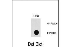 Dot blot analysis of Phospho-P3K7- polyclonal antibody (Cat. (MAP3K7 antibody  (pThr187))