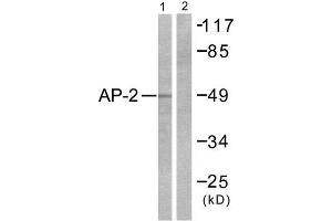 Western Blotting (WB) image for anti-Transcription Factor AP-2 alpha (Activating Enhancer Binding Protein 2 Alpha) (TFAP2A) (C-Term) antibody (ABIN1848431) (TFAP2A antibody  (C-Term))