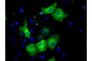 Anti-SORD mouse monoclonal antibody (ABIN2453676) immunofluorescent staining of COS7 cells transiently transfected by pCMV6-ENTRY SORD (RC200415). (SORD antibody)