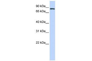 TFR2 antibody used at 1 ug/ml to detect target protein. (Transferrin Receptor 2 antibody  (Middle Region))