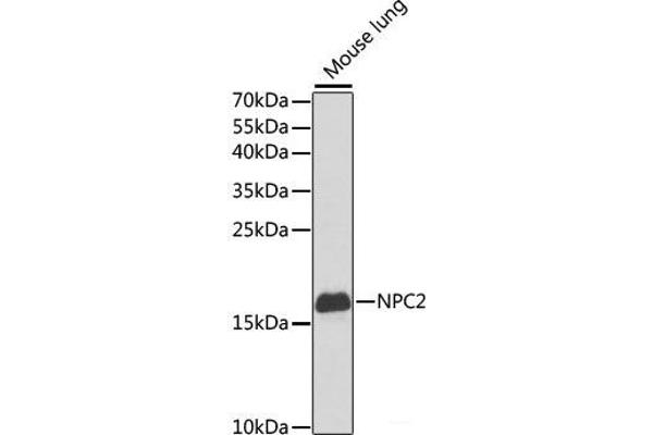 NPC2 antibody