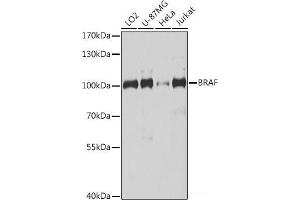 Western blot analysis of extracts of various cell lines using BRAF Polyclonal Antibody at dilution of 1:1000. (BRAF antibody)