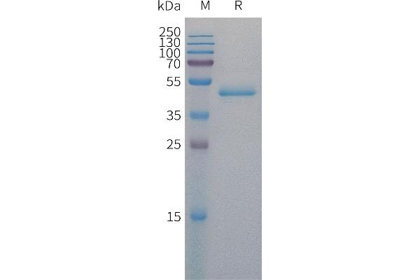 PAI1 Protein (AA 24-402) (His tag)