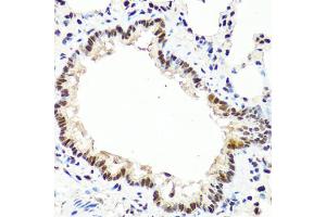 Immunohistochemistry of paraffin-embedded rat lung using TET2 antibody. (TET2 antibody)