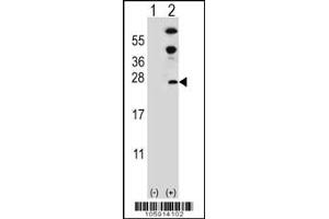 Western blot analysis of DUSP14 using rabbit polyclonal DUSP14 Antibody (D183) using 293 cell lysates (2 ug/lane) either nontransfected (Lane 1) or transiently transfected (Lane 2) with the DUSP14 gene. (DUSP14 antibody  (C-Term))