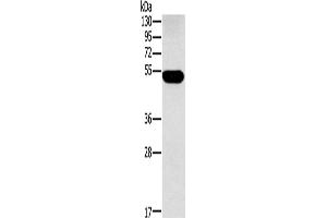 Western Blotting (WB) image for anti-Fucosidase, alpha-L- 1, Tissue (FUCA1) antibody (ABIN2430139) (FUCA1 antibody)