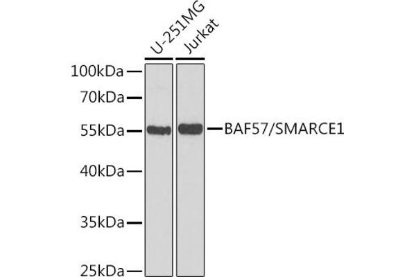 SMARCE1 antibody  (AA 1-411)