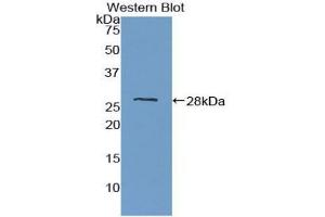 Western blot analysis of the recombinant protein. (PTPRM antibody  (AA 1197-1403))