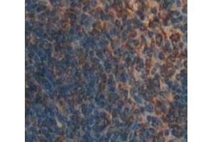 IHC-P analysis of Kidney tissue, with DAB staining. (DC-SIGN/CD209 antibody  (AA 115-238))