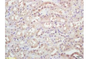 Formalin-fixed and paraffin embedded rat kidney labeled with Rabbit Anti KIFC1 Polyclonal Antibody, Unconjugated (ABIN873143) at 1:200 followed by conjugation to the secondary antibody and DAB staining (KIFC1 antibody)