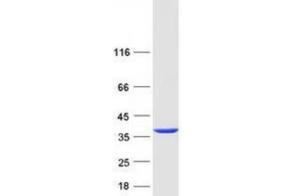 Tropomyosin 4 Protein (TPM4) (Transcript Variant 2) (Myc-DYKDDDDK Tag)