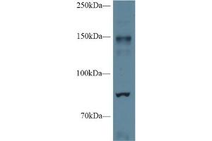 Western Blot; Sample: Mouse Cerebrum lysate; Primary Ab: 1µg/ml Rabbit Anti-Mouse NOS2 Antibody Second Ab: 0. (NOS2 antibody  (AA 43-213))