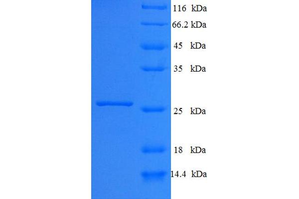 Ephrin B3 Protein (EFNB3) (AA 28-227) (His tag)