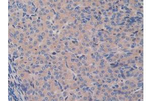 IHC-P analysis of Mouse Ovary Tissue, with DAB staining. (GAB3 antibody  (AA 142-375))