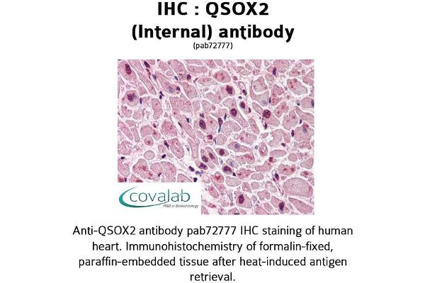 QSOX2 antibody  (Internal Region)