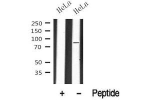 Western blot analysis of eIF2B in lysates of HeLa? (EIF2B5 antibody)