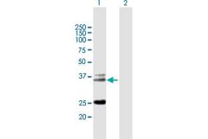 Western Blot analysis of TRA@ expression in transfected 293T cell line by TRA@ MaxPab polyclonal antibody. (TCR alpha antibody  (AA 1-278))