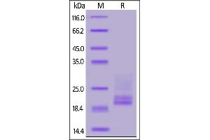 Human CD3E&CD3D Heterodimer Protein, His Tag&Tag Free on  under reducing (R) condition. (CD3D & CD3E (AA 23-126) (Active) protein (His tag))