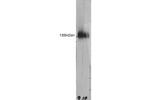 Western strip blots of HeLa cell crude extracts stained with anti LAMP1 antibody ABIN1580431 in strip 9. (LAMP1 antibody)