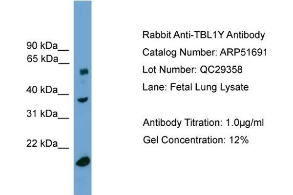 TBL1Y antibody  (Middle Region)