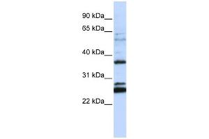 WB Suggested Anti-FAM70A Antibody Titration:  0. (FAM70A antibody  (N-Term))