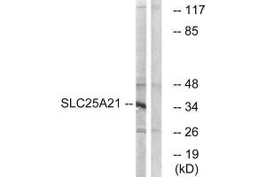 Western Blotting (WB) image for anti-Solute Carrier Family 25 (Mitochondrial Oxodicarboxylate Carrier), Member 21 (Slc25a21) (Internal Region) antibody (ABIN1851570) (SLC25A21 antibody  (Internal Region))