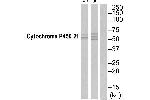 Western blot analysis of extracts from Jurkat/HeLa cells, using CYP21A2 antibody. (CYP21A2 antibody  (C-Term))