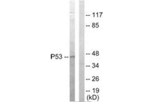 Western blot analysis of extracts from HepG2 cells, using p53 Antibody. (p53 antibody  (AA 301-350))