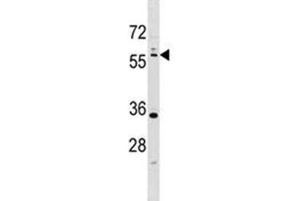 LKB1 antibody  (AA 14-44)